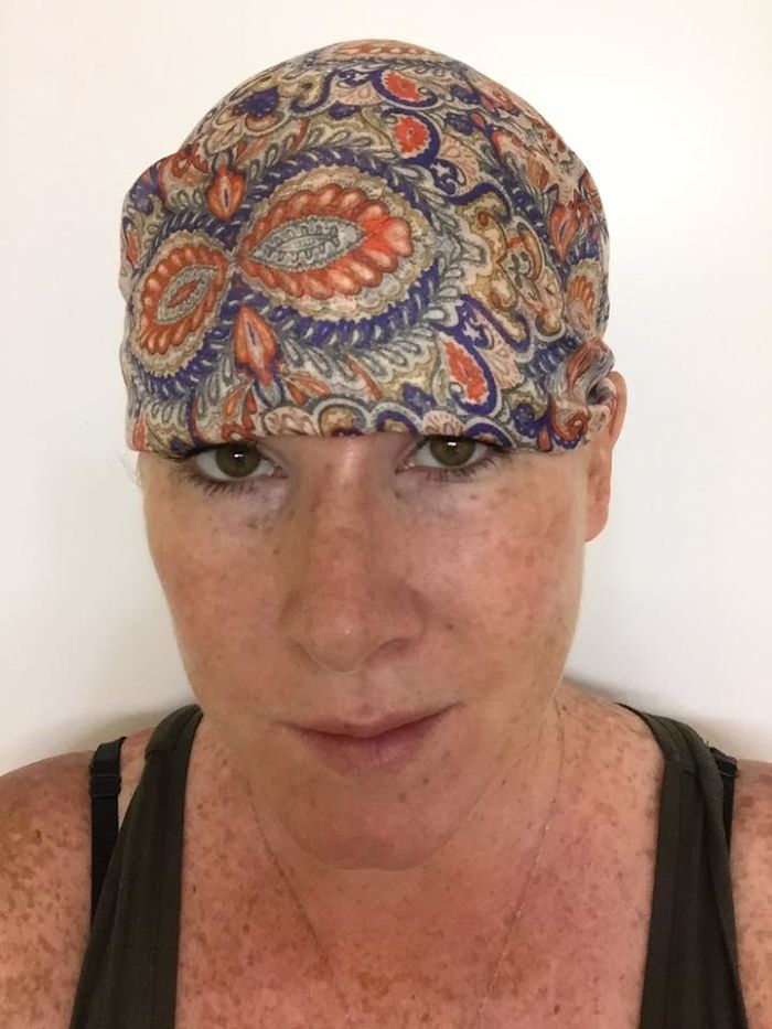 If This Mom's Before & After Photos Don't Scare You About Skin Cancer, Nothing Will