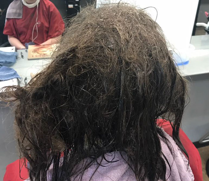 Hairdresser Refuses To Shave Depressed Teen’s Hair, Spends 13 Hours Fixing It