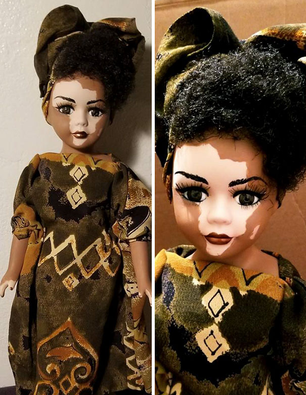 Esta artista crea muñecas con vitiligo para niños que sufren esta enfermedad de la piel