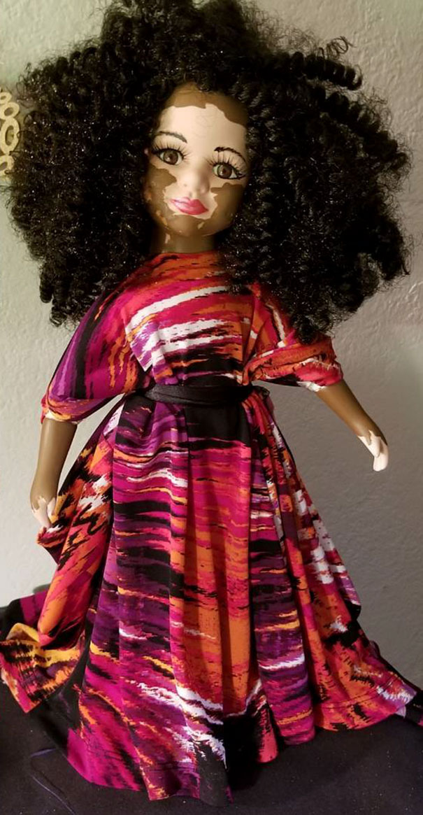 Esta artista crea muñecas con vitiligo para niños que sufren esta enfermedad de la piel