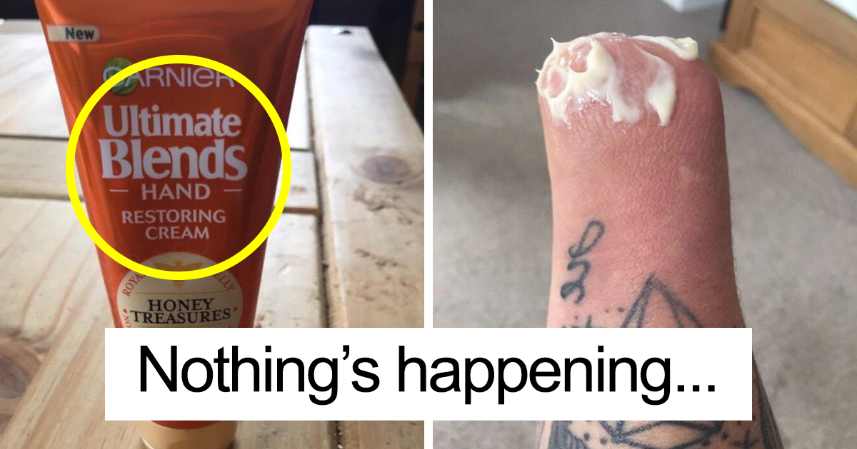 51 Amputees Who Lost Their Limbs, But Not Their Humor | Bored Panda