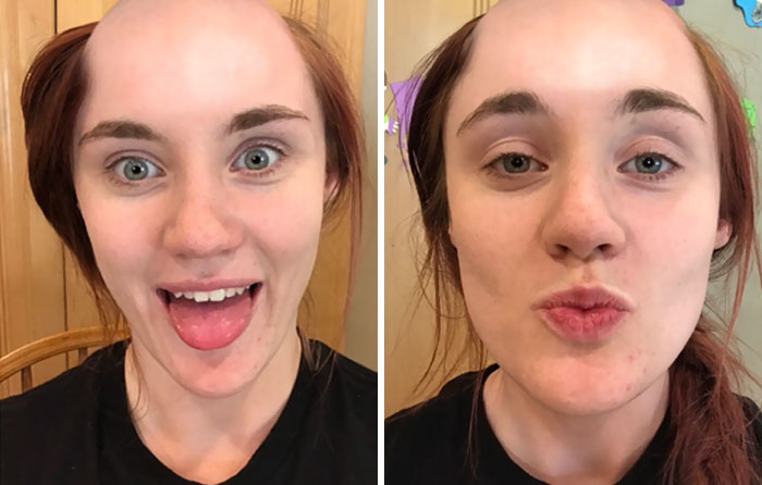 Girlfriend Texts Boyfriend She Shaved Her Head, Doesn’t Expect Reaction Like This