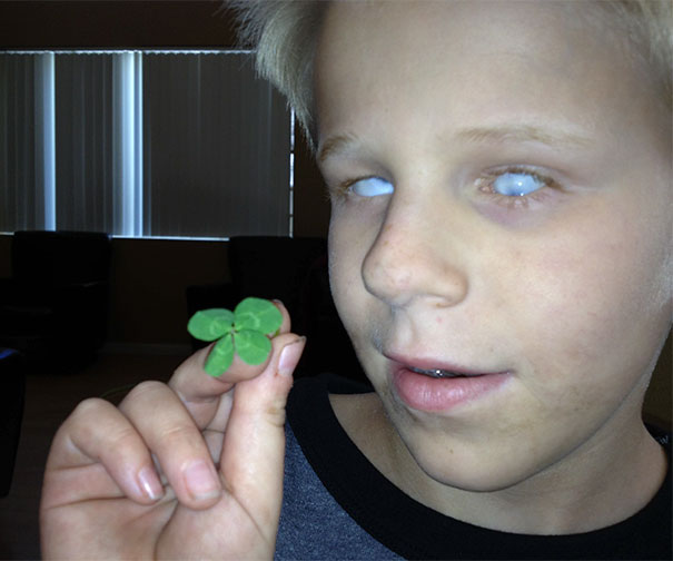 My Blind Son Found A Four Leaf Clover On His Own. What Are The Odds?