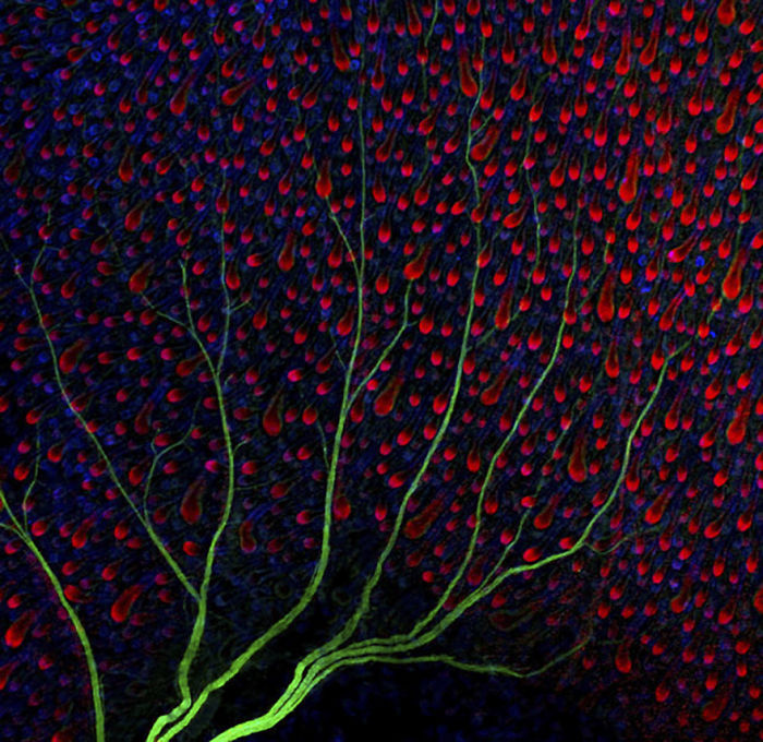 Nervios (verdes) bajo la piel de un ratón (lo azul y rojo son folículos capilares), Reino unido, imagen distinguida
