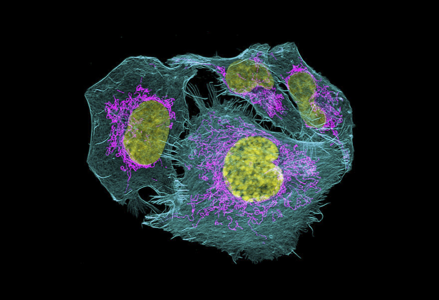 Prostate Cancer Cells, Usa, Image Of Distinction