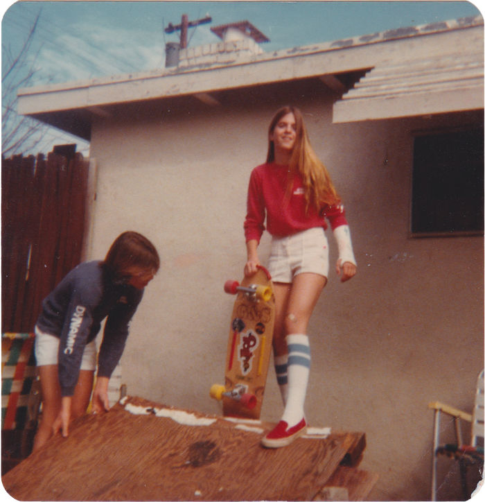 Mi madre haciendo skate con la muñeca rota, a finales de los 70