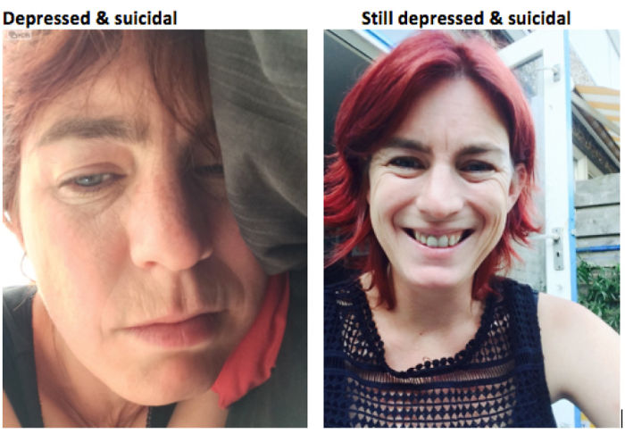 No Mask, Just Me. The Face Of Depression, In Both Images.