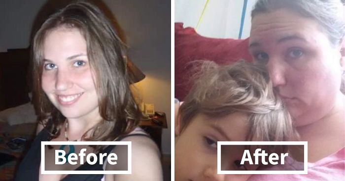 Got Todlerred: Parents Are Sharing Photos Of Them Before And After Having Kids, And The Difference Is Too Real