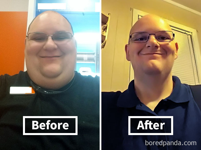 What Losing Almost 200 Lbs Does For Your Face
