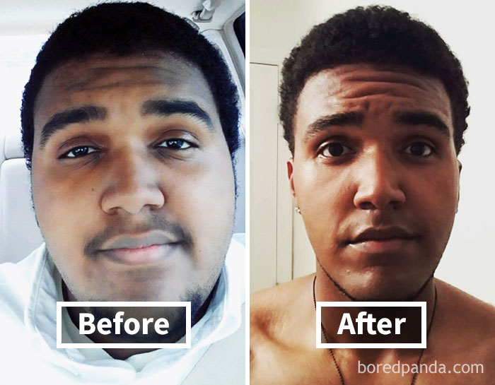Before And After Weight Loss Men Face 128 Surprising Photos Of Face