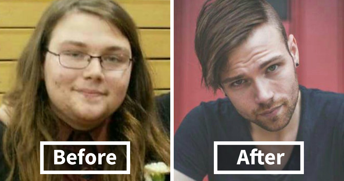 128 Surprising Photos of Face Fat Loss Before and After Weight