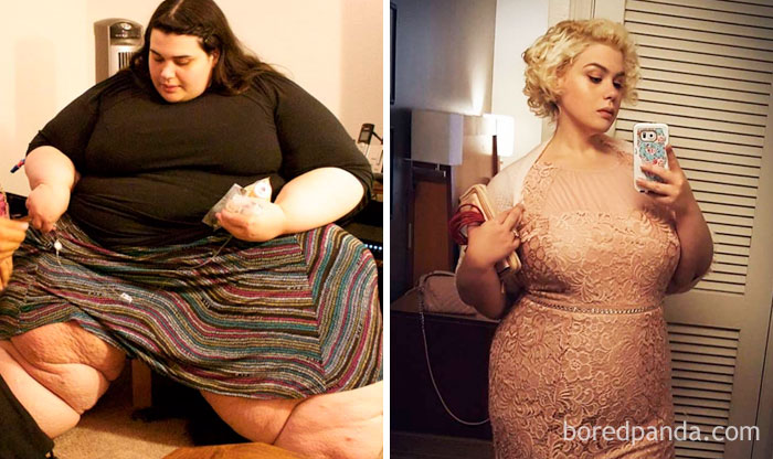 My 600-Pound Life - Before And After