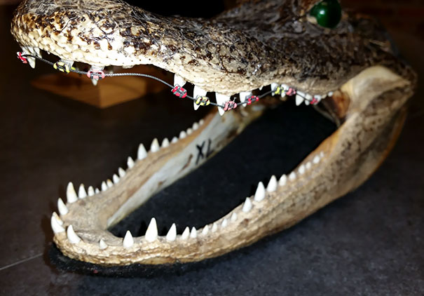 My Orthodontist Has A Crocodile Head With Braces On Its Teeth