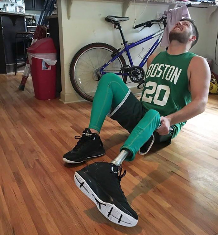Friend Who Lost His Leg To Cancer Got Creative For Halloween