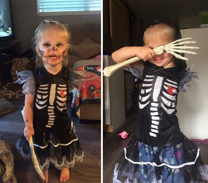 3-Year-Old Amputee With Her One-Of-A-Kind Halloween Costume