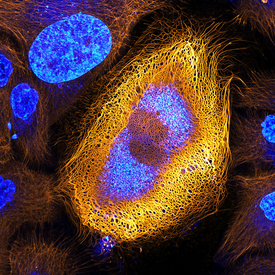 Immortalized Human Skin Cells Expressing Fluorescently Tagged Keratin, Amsterdam, 1st Place