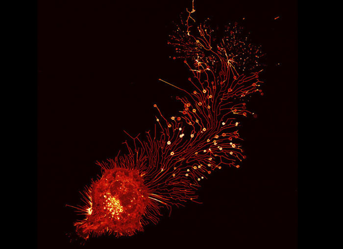 Migrasoma de un fibroblasto de ratón, Pekín, imagen distinguida