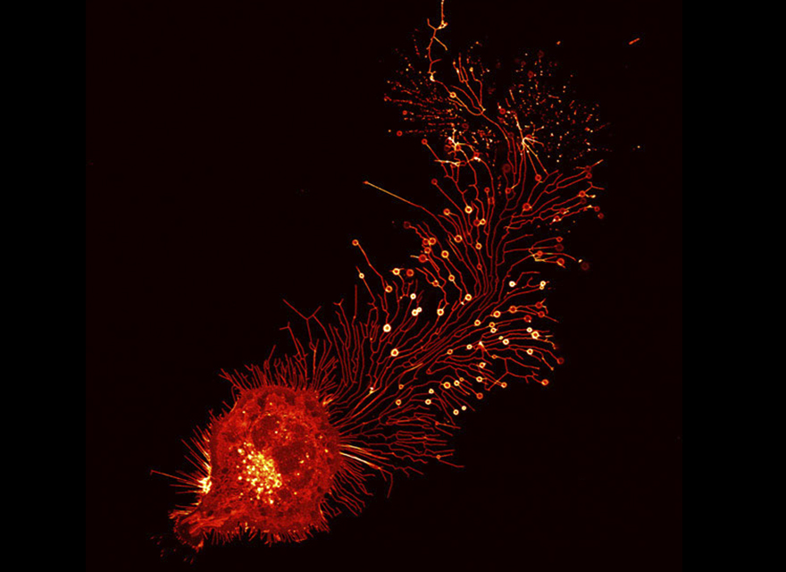 Migrasome Of A Mouse Fibroblast Cell (L929), Beijing, Image Of Distinction