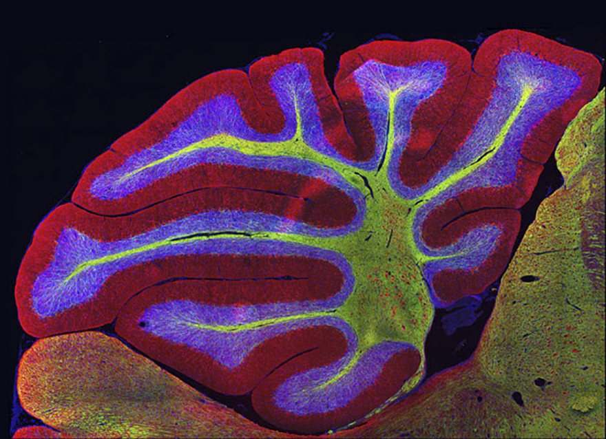 Sagittal Section Of Mouse Cerebellum (Brain), Athens, Image Of Distinction
