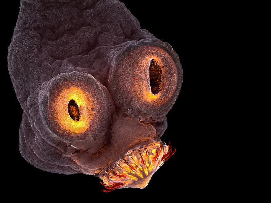 The Head Of A Pork Tapeworm, New York, 4th Place