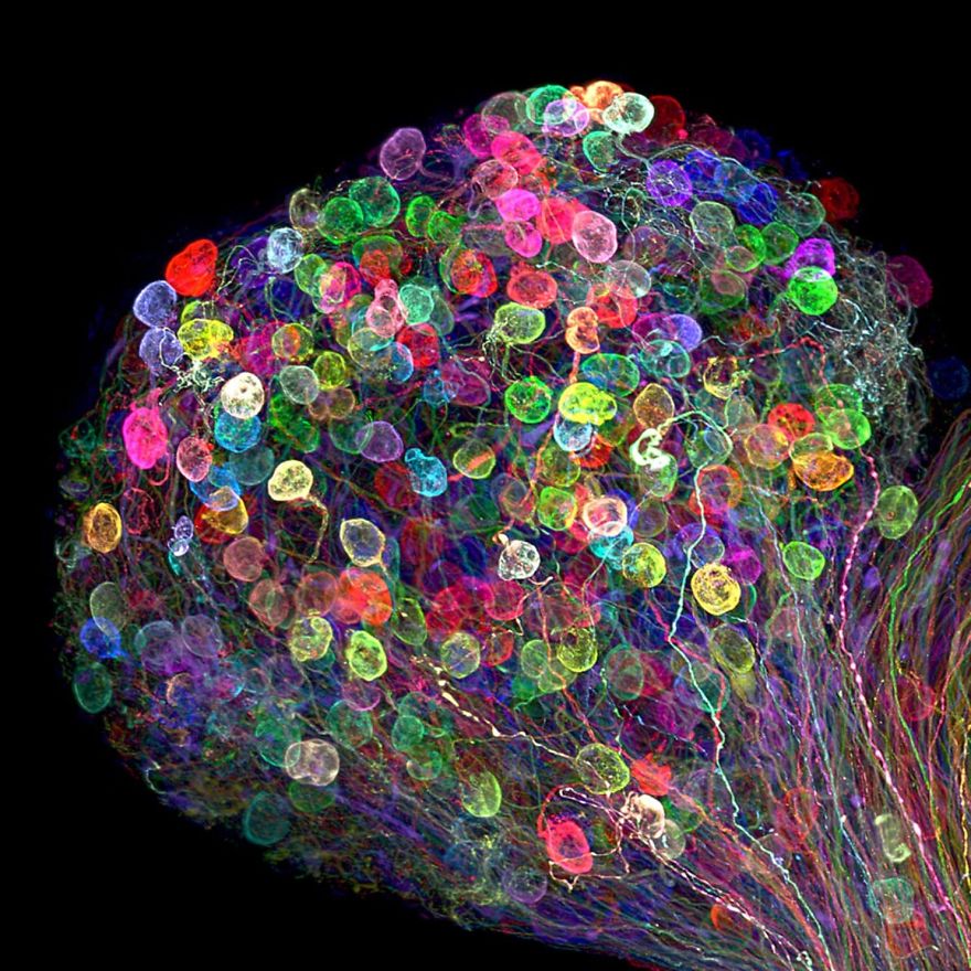 Individually Labeled Axons In An Embryonic Chick Ciliary Ganglion, Nagoya, 7th Place