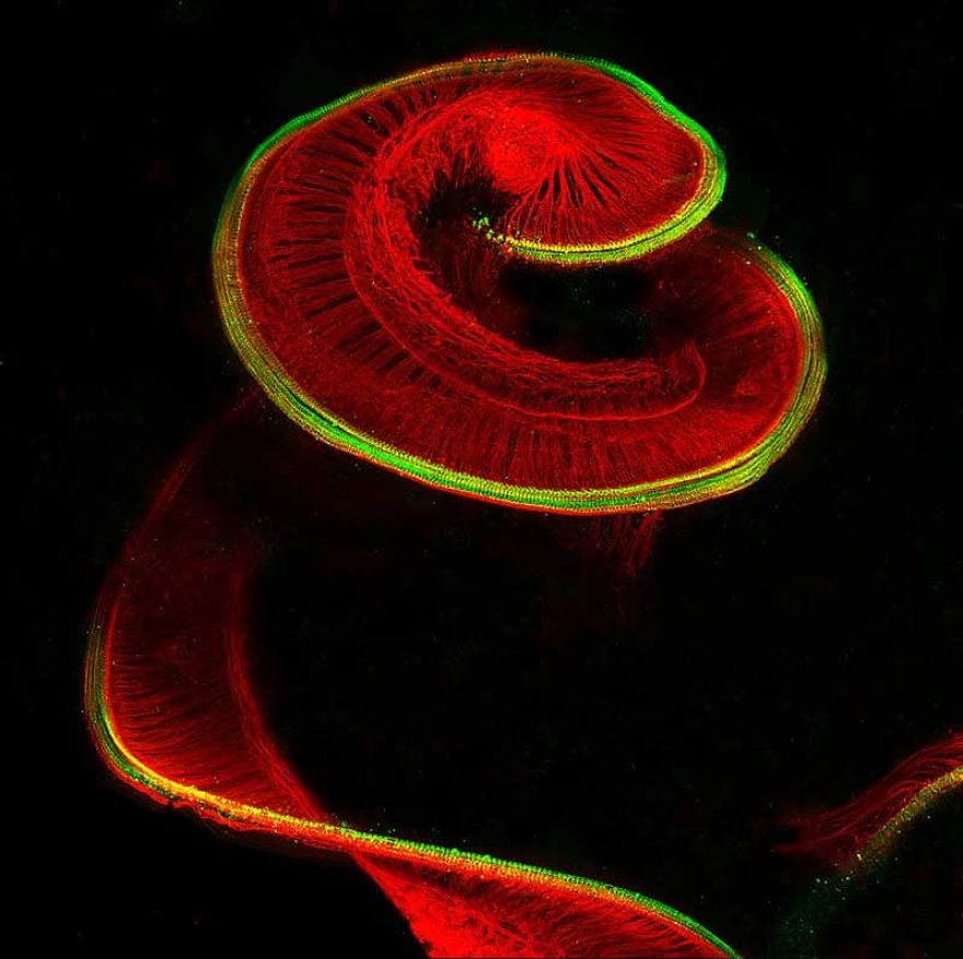 Newborn Rat Cochlea With Sensory Hair Cells (Green) And Spiral Ganglion Neurons (Red), Bern, 8th Place