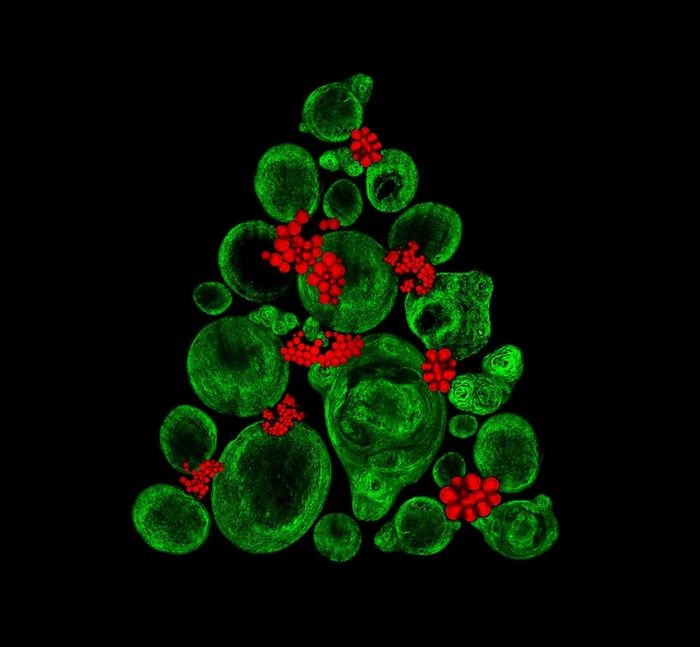 Cultivando tejido cartilaginoso en el laboratorio usando células de tuétano (colágeno en verde, depósitos de grasa en rojo), Southampton, 9º puesto