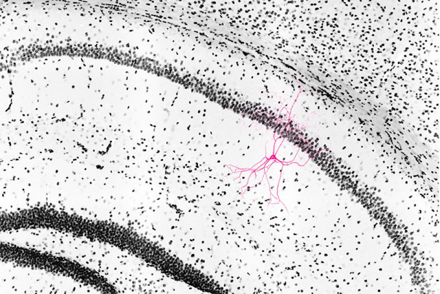 Dye-Injected Hippocampal Interneuron In Mouse Brain Section, Budapest, Honorable Mention
