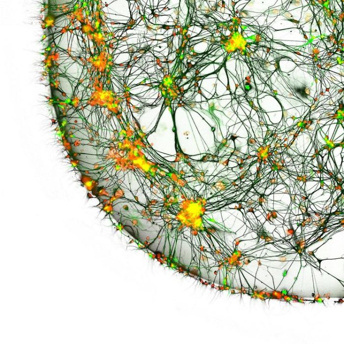 Neuronas de un paciente con Alzheimer, Seongnam, mención de honor