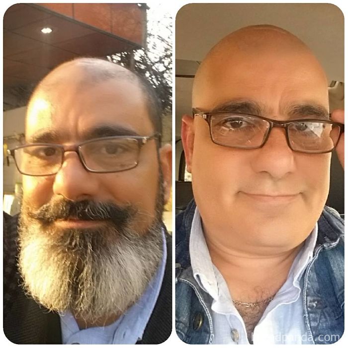 #before And After Beard