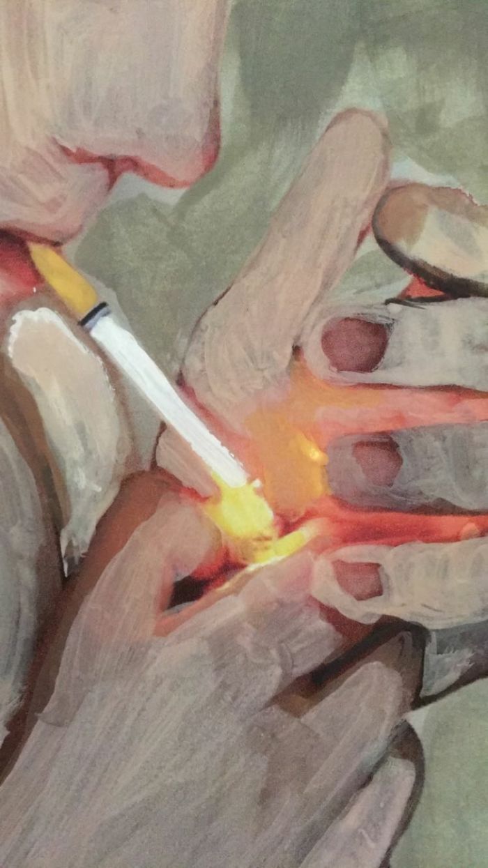 19 Year Old Uses Art To Cope With Mental Illness
