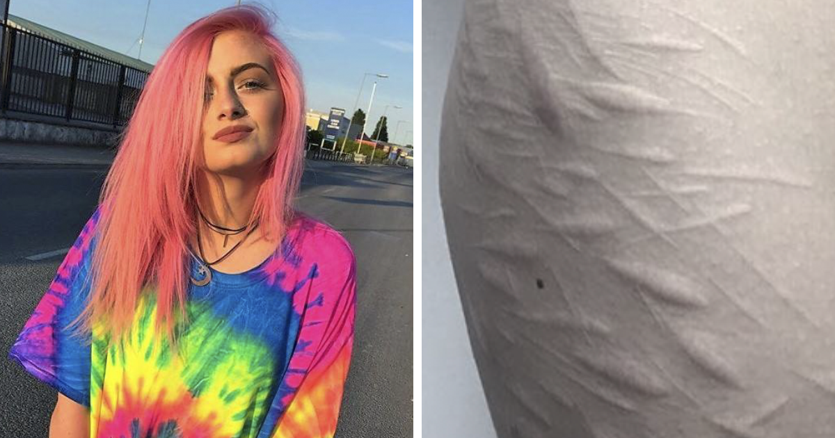 19 . Found A Tattoo Artist To Help Cover Self-Harm Scars | Bored Panda
