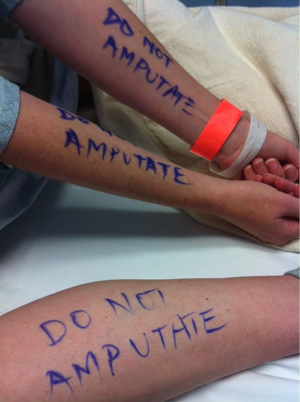 Had Minor Surgery Today. My Husband Didn't Want To Take Any Chances So He Wrote Instructions On My Arms And Legs