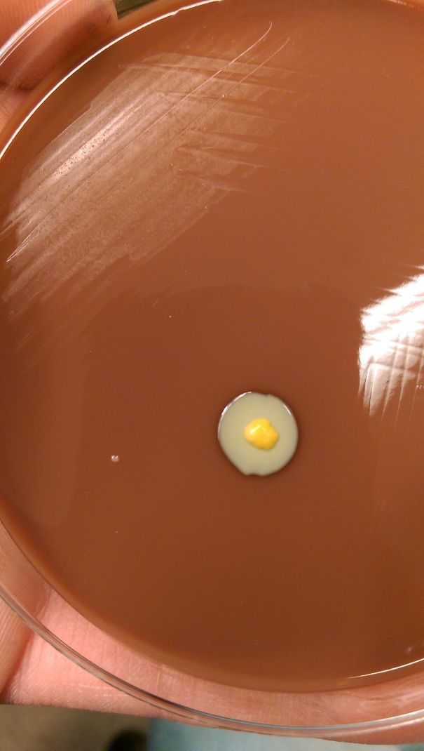 The Way This Bacteria Is Growing Makes It Look Just Like A Fried Egg