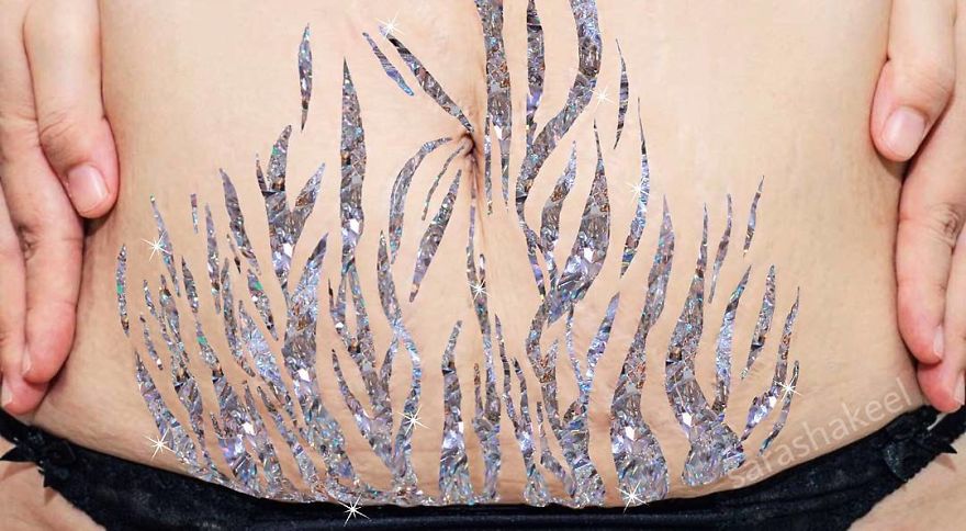 Artist Turns Stretch Marks Into Art In Order To Encourage People To Be Proud Of Them