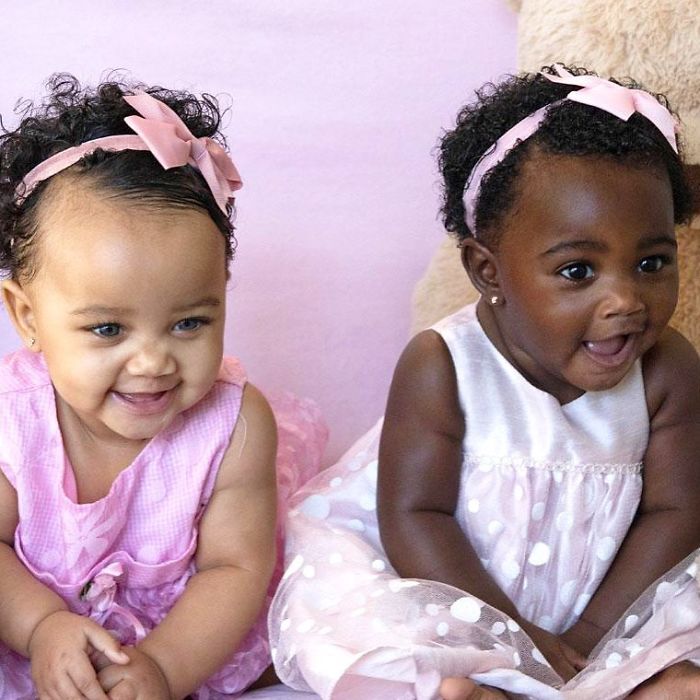Girls Born In Different Colors Make It Nearly Impossible To Tell They Are Twins