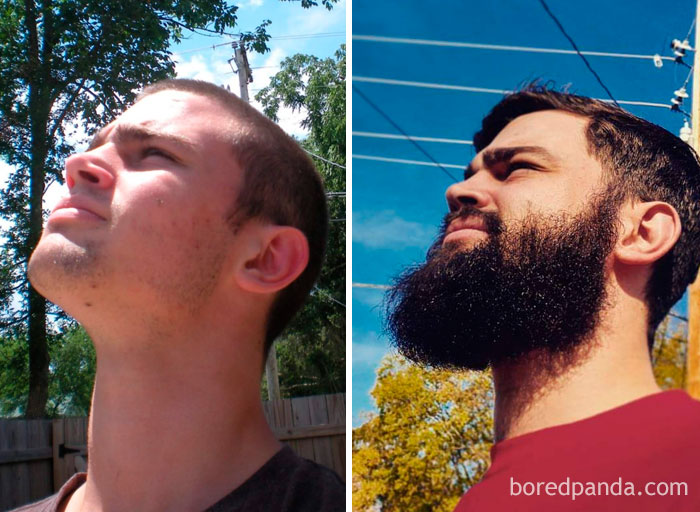 Before And After. If Anyone Tries To Tell You That Beards Are A Bad Thing, Look What It Did For Me. Left Was Late 2012, Right Was Election Day 2016