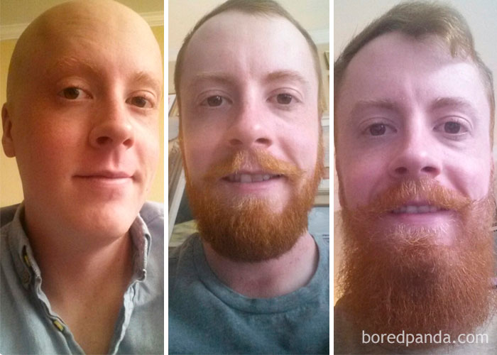 Before & After Pics Of Guys Growing Their Beards | Bored Panda
