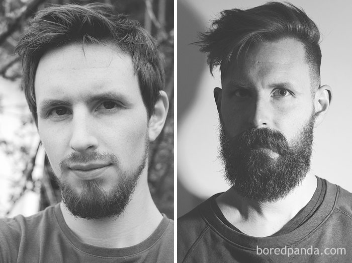 Beard Growth Pattern At 23 Versus 28 Years Old. Just Goes To Show That There Is Hope Even For The Latest Of Bloomers