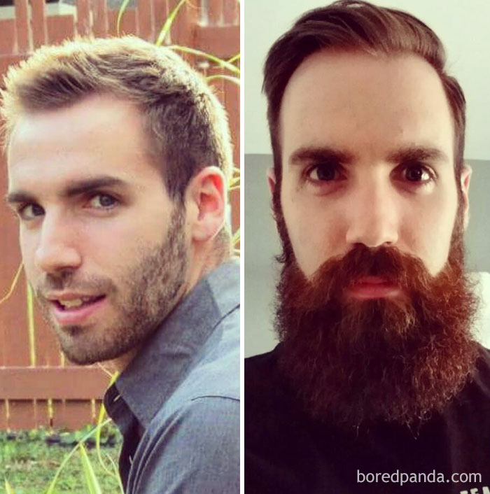 Beard Progression. Left Or Right?