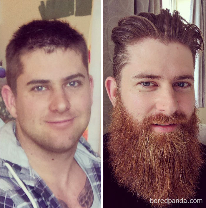 30 Before And After Pics That Will Make You Reconsider Shaving Your