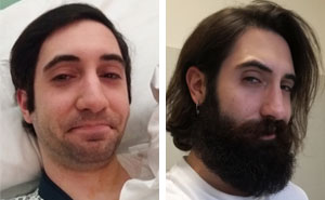 30+ Before & After Pics That Will Make You Reconsider Shaving Your Beard