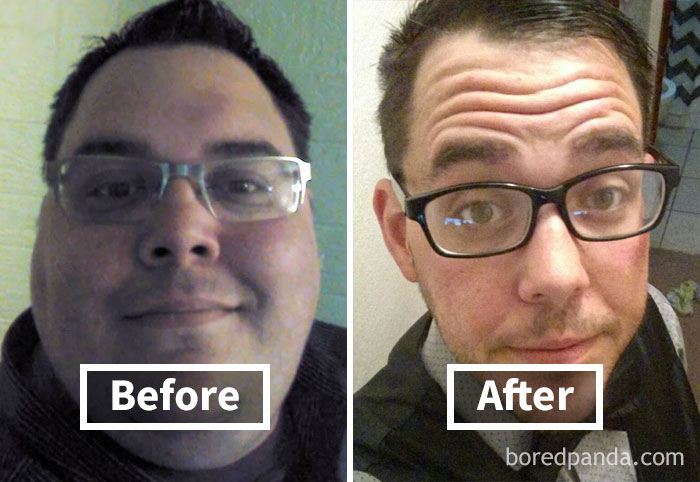 Man with glasses before weight loss and after
