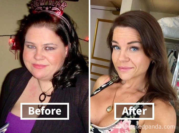 Woman with dark hair before weight loss and after