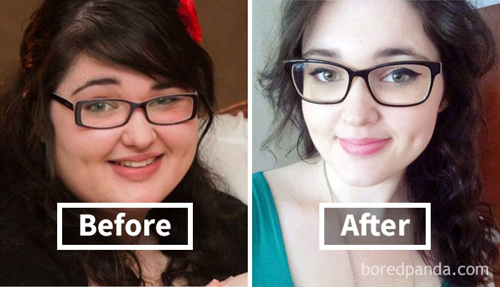 What Losing 60 Kg Did To My Face