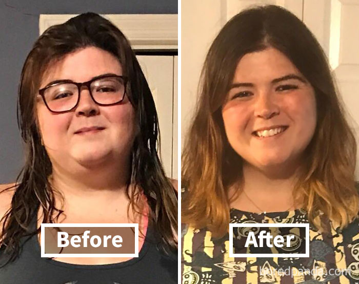 Woman with glasses before weight loss and after