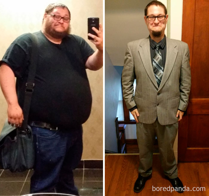 In The Last Year I Have Lost Over 200 Lbs From Exercise And Gastric Sleeve Surgery