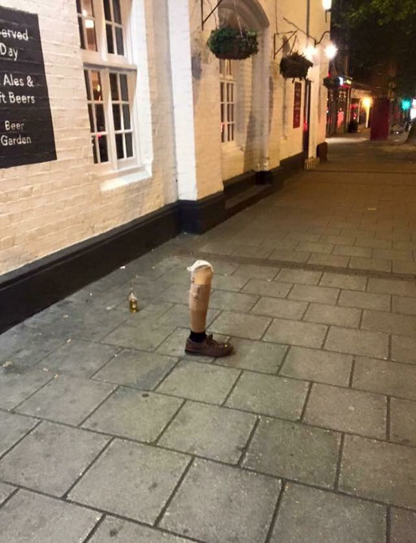 Ever Been So Drunk, You Left Your Leg Outside The Pub?