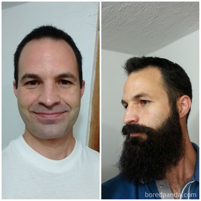 9 Months Beard