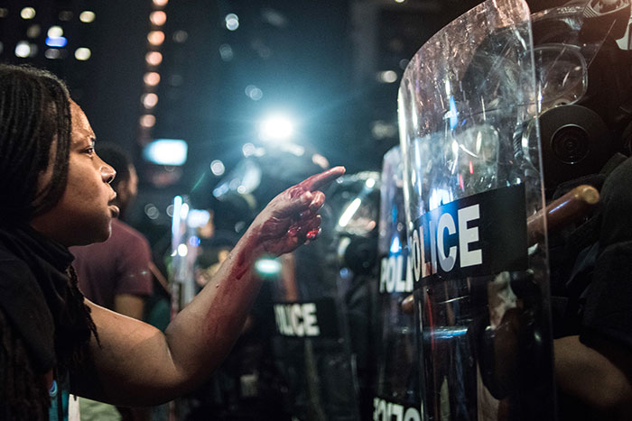 With Blood Covering Her Hand And Arm, A Woman Points At A Police Officer In Charlotte, Nc, 21 September 2016 